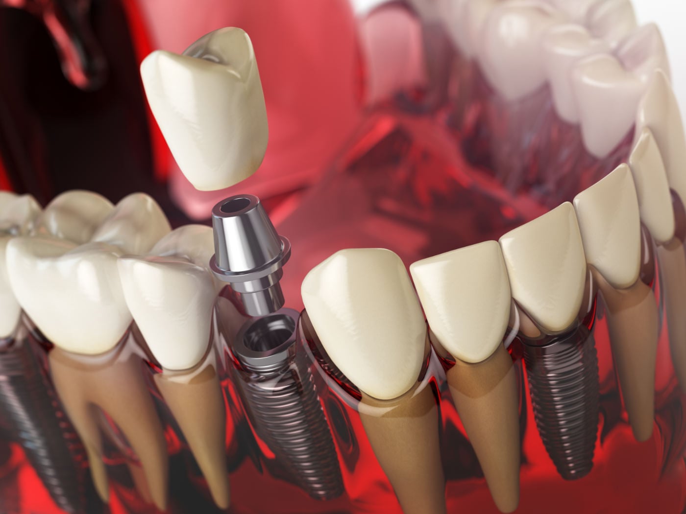 Aurora Family Dental Care
